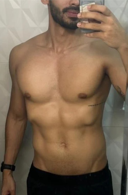 Depois: Lucas Gomes