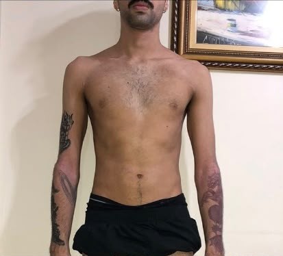 Antes: Victor Mota