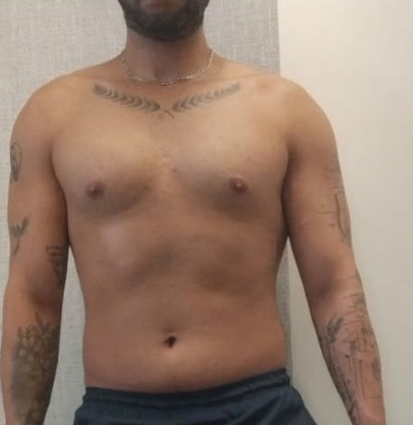 Antes: Diego Bispo