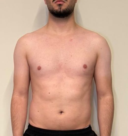 Antes: João Evandro