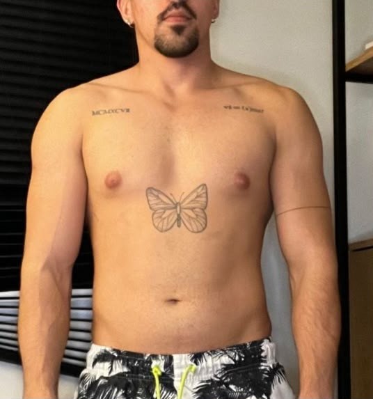 Antes: Matheus Mendes
