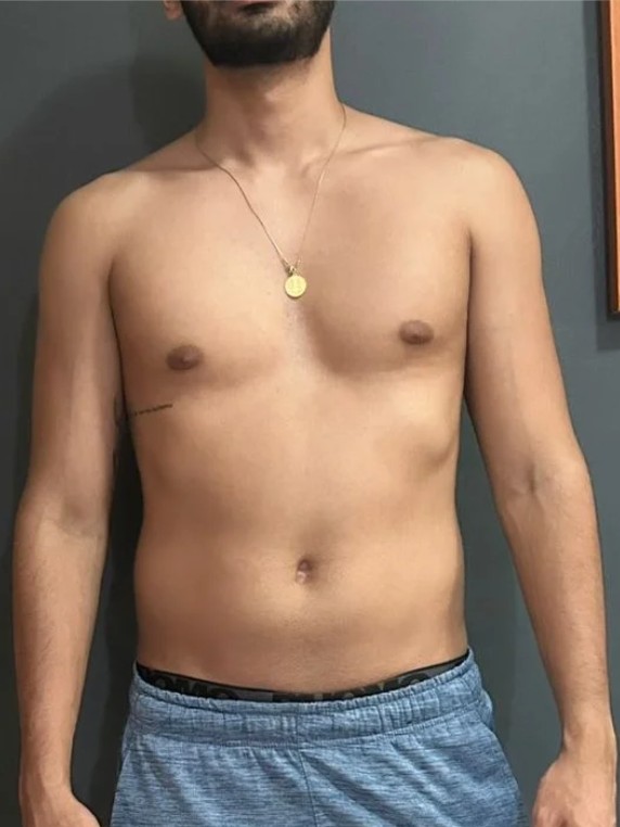 Antes: Lucas Gomes