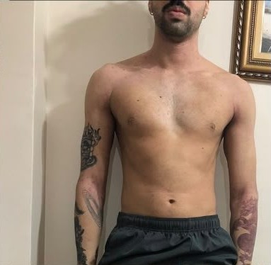 Depois: Victor Mota