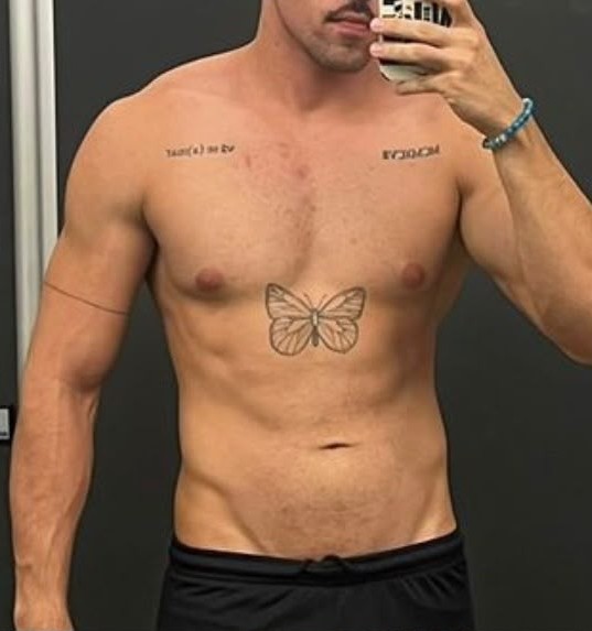 Depois: Matheus Mendes