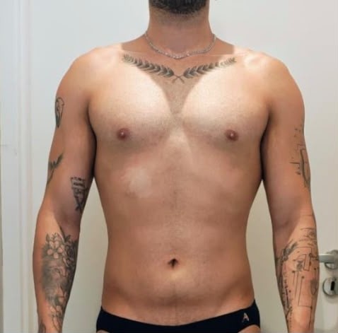 Depois: Diego Bispo