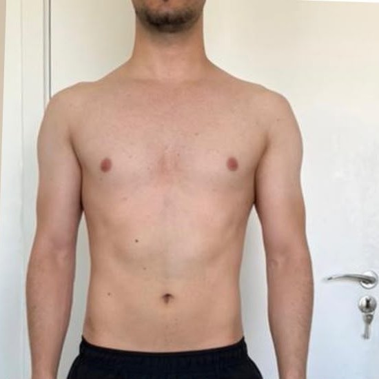 Depois: João Evandro
