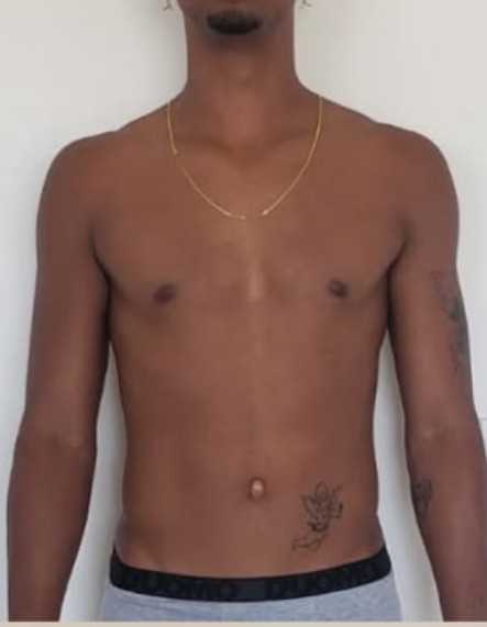 Antes: Eric Nascimento